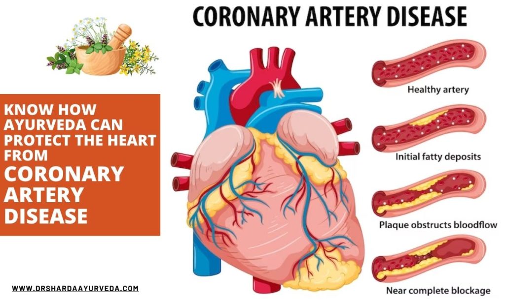 Know how Ayurveda can protect the heart from Coronary Artery Disease
